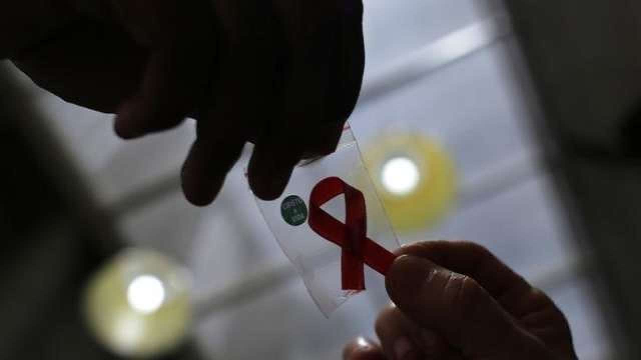  hiv-aids