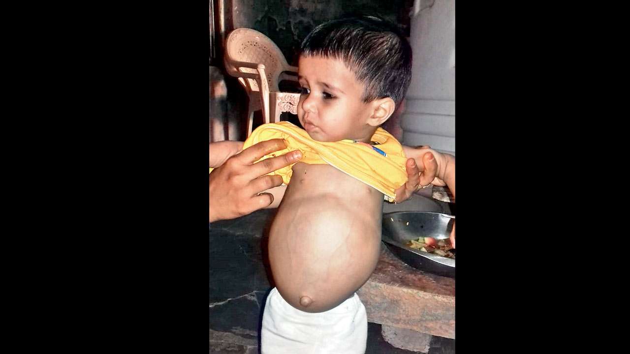 Rajasthan: He lost his daughter to it, fears the same fate for son