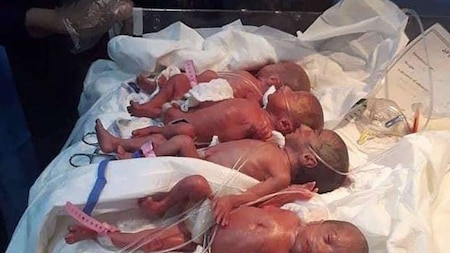 Young mom gave birth to septuplets