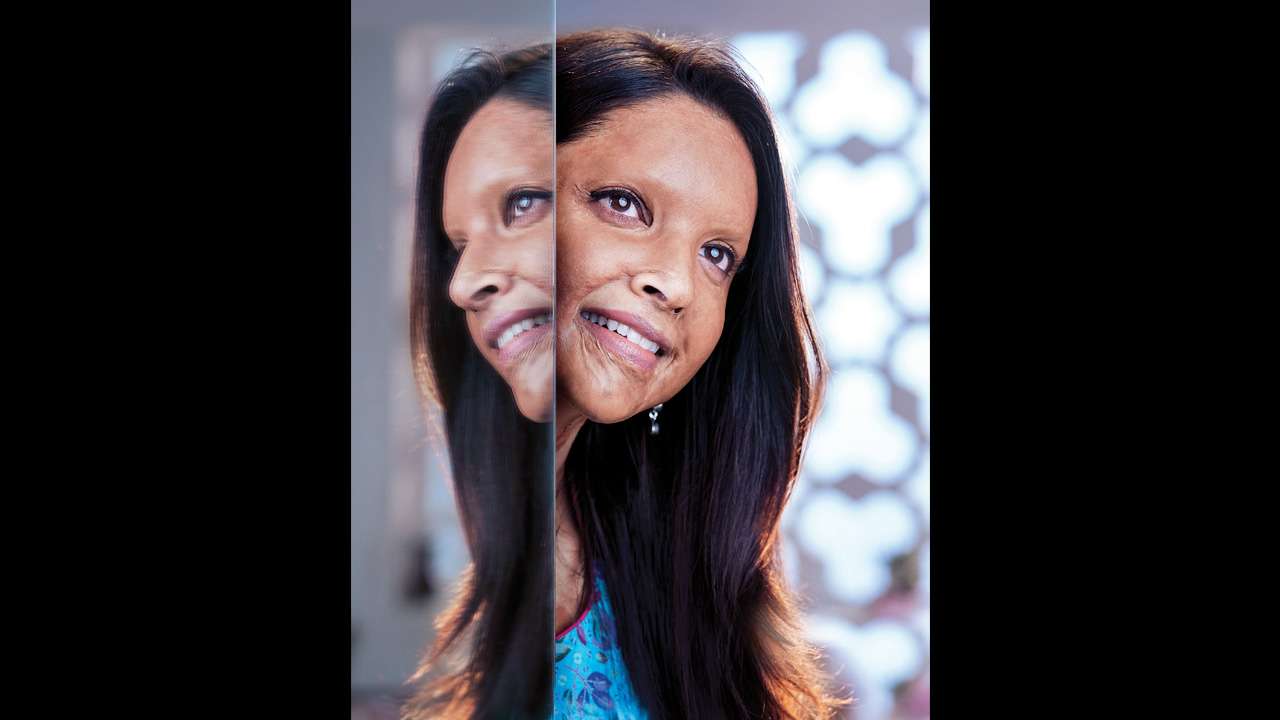 Exclusive! Deepika Padukone's FIRST LOOK as Malti in 'Chhapaak' REVEALED!