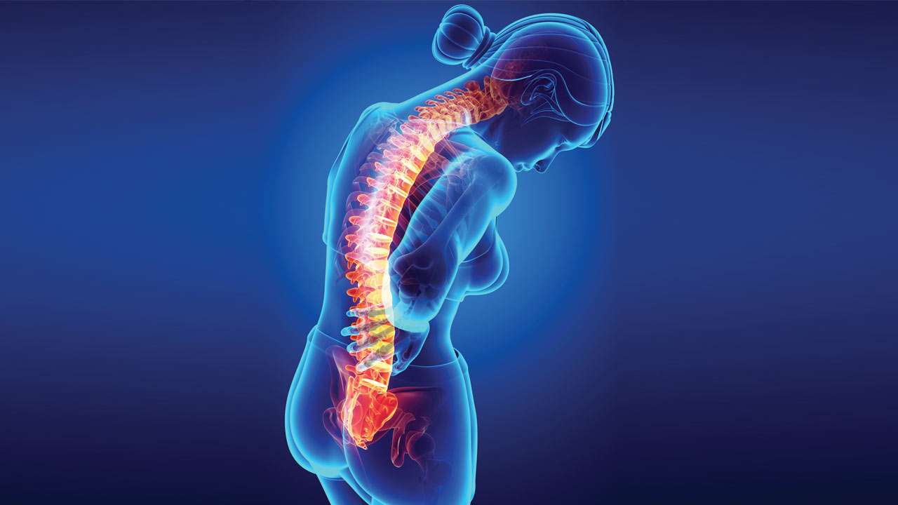 Spinal disorders