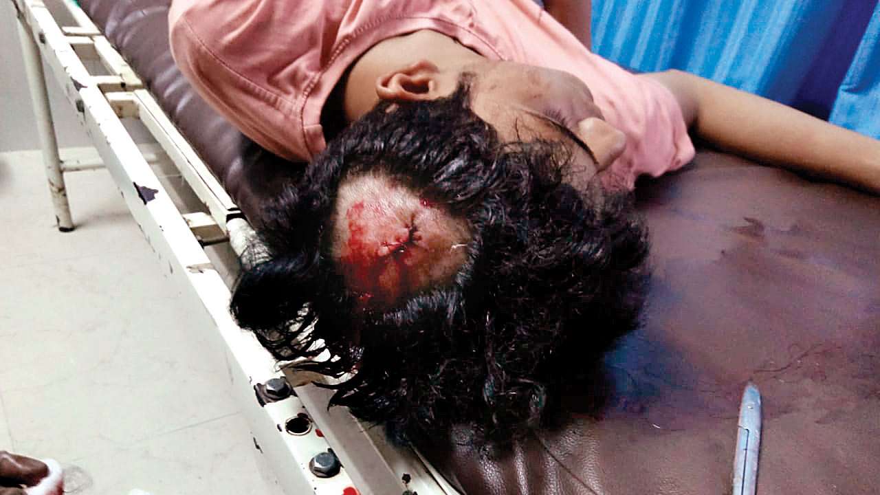Mumbai: 16-yr-old hit on skull on confronting teen who harassed girl