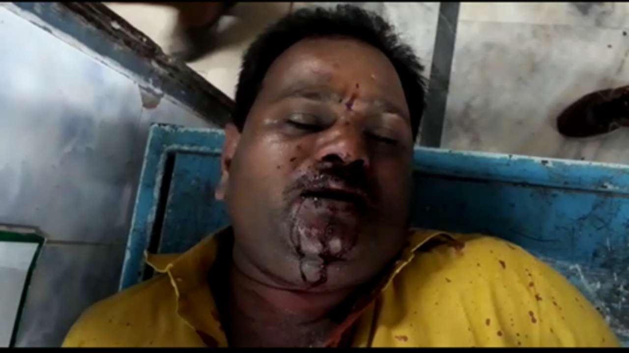 BJP worker badly injured