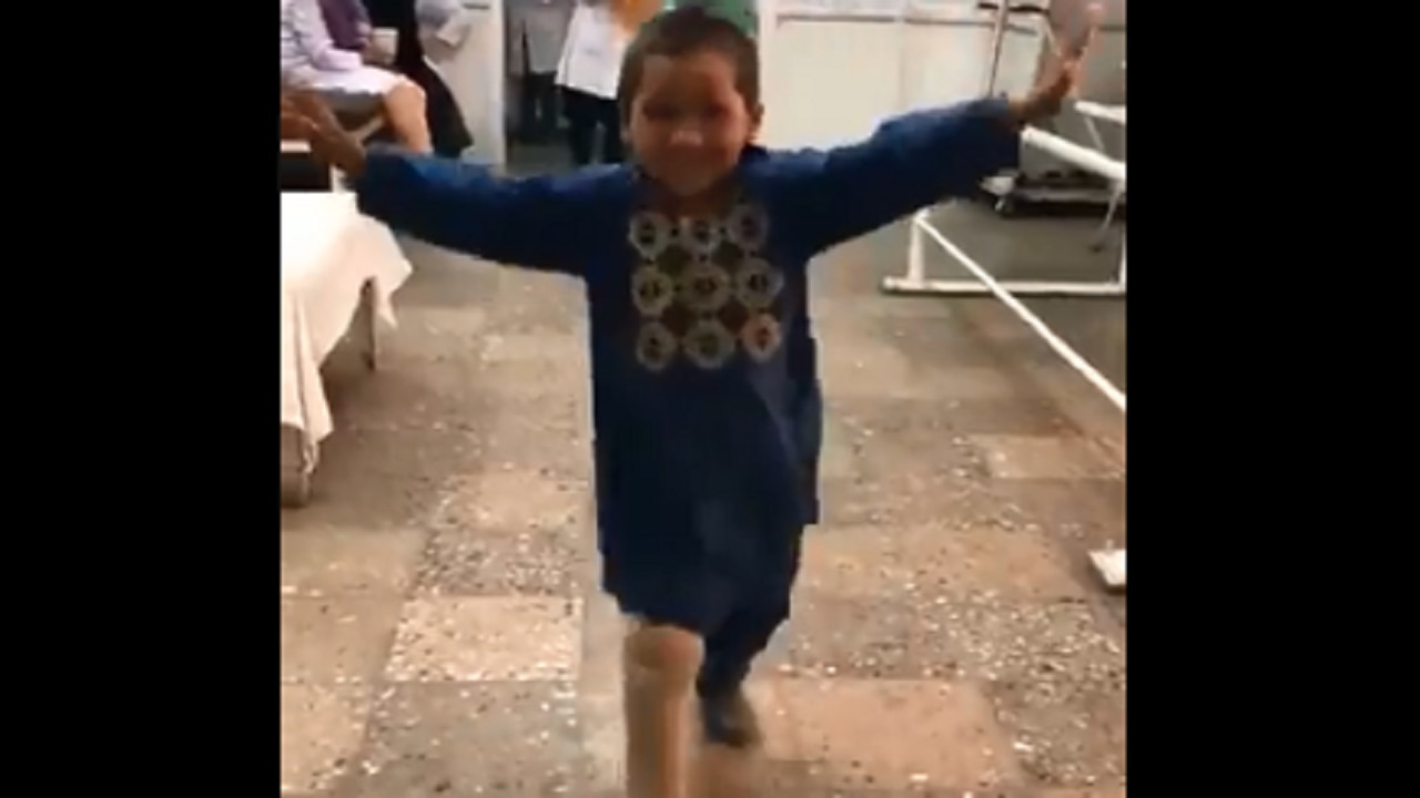 Image result for afghanistan boy dances after leg implant