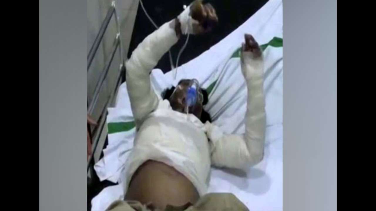Kanti Devi's condition is now said to be stable