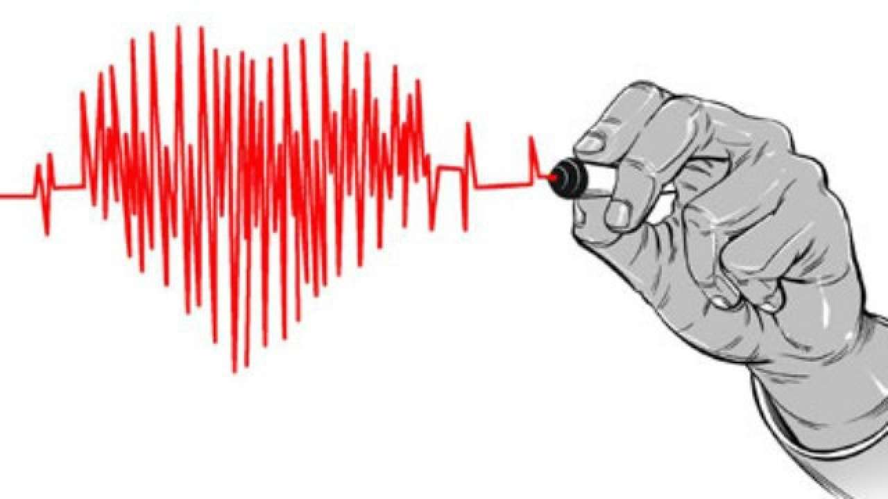 Picture for representation