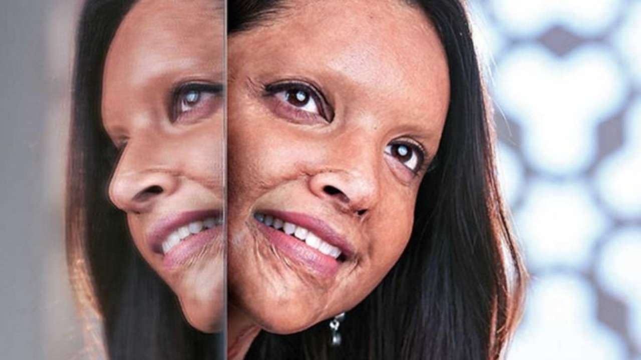 Here S Why Deepika Padukone Burnt Chhapaak Prosthetics On Last Day India's first prosthetic makeup studio in mumbai. here s why deepika padukone burnt
