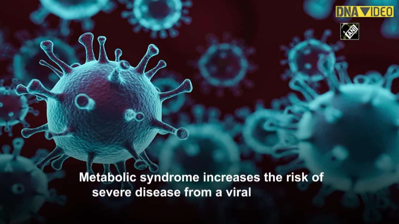 Obesity and metabolic syndrome are risk factors for severe influenza