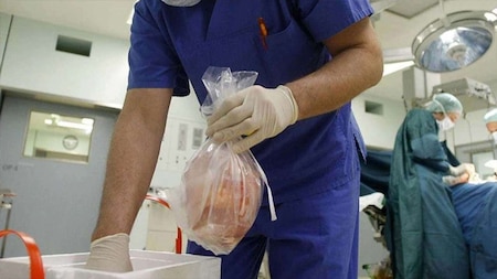 Heart was transplanted to a four-year-old Russian boy