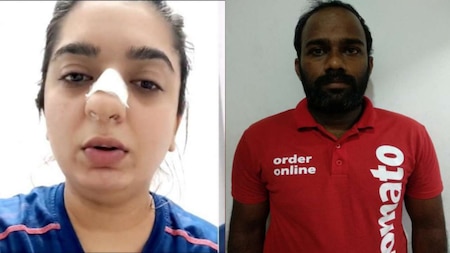 Hitesha accused Zomato delivery executive of physical violence