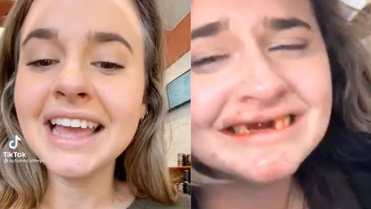 Ouch! Girl loses teeth after having too many mimosas, viral video ...