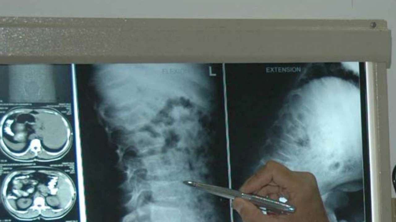 CT scan