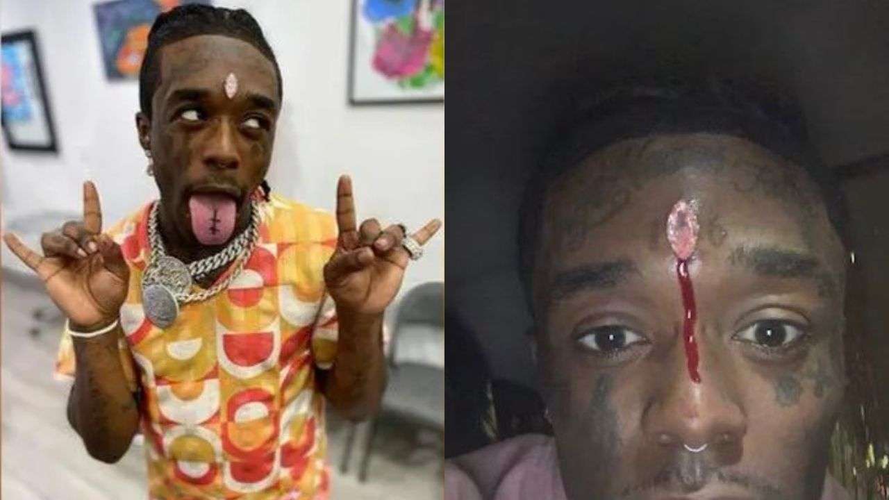 US rapper Lil Uzi Vert reveals fans ripped out his Rs 175 crore forehead  diamond, photos surface online