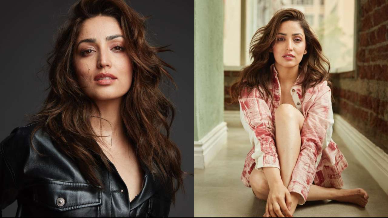Yami Gautam reveals she suffers from a skin condition, drops unedited pics