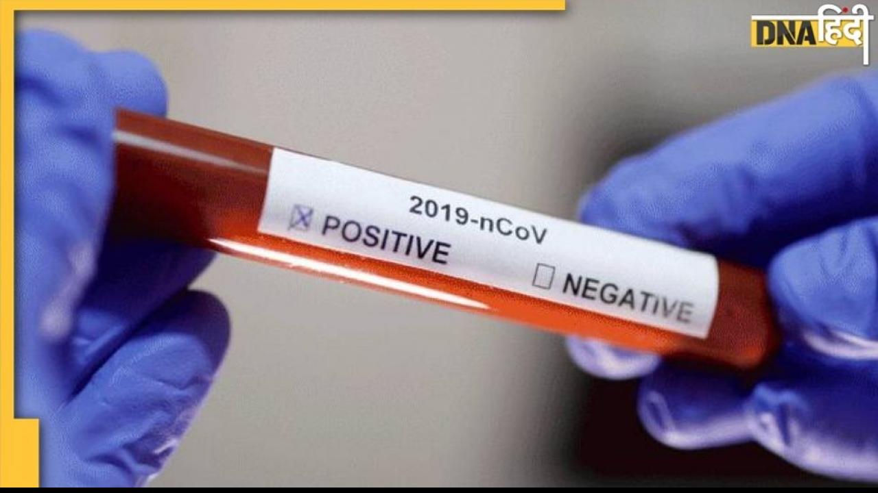 Coronavirus Update: 8,503 नए मामले आए सामने, एक दिन में 624 लोगों की मौत