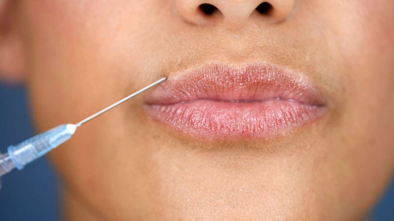 Fillers