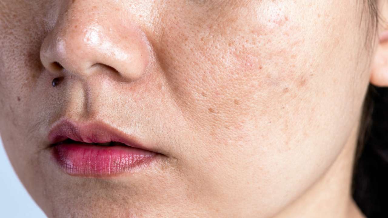PRP for Face