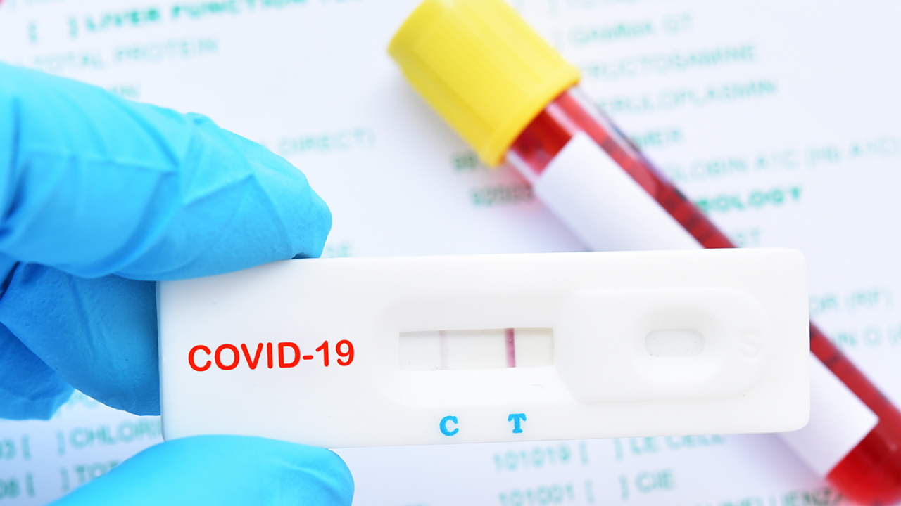 Positive test kit covid You Can