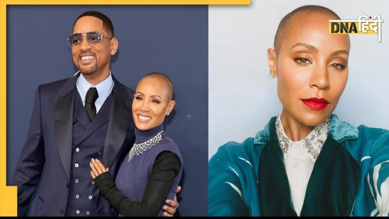 Alopecia कंडीशन से जूझ रही हैं Will Smith की पत्नी जेडा, जानें- क्या है बाल झड़ने वाली यह गंभीर बीमारी?