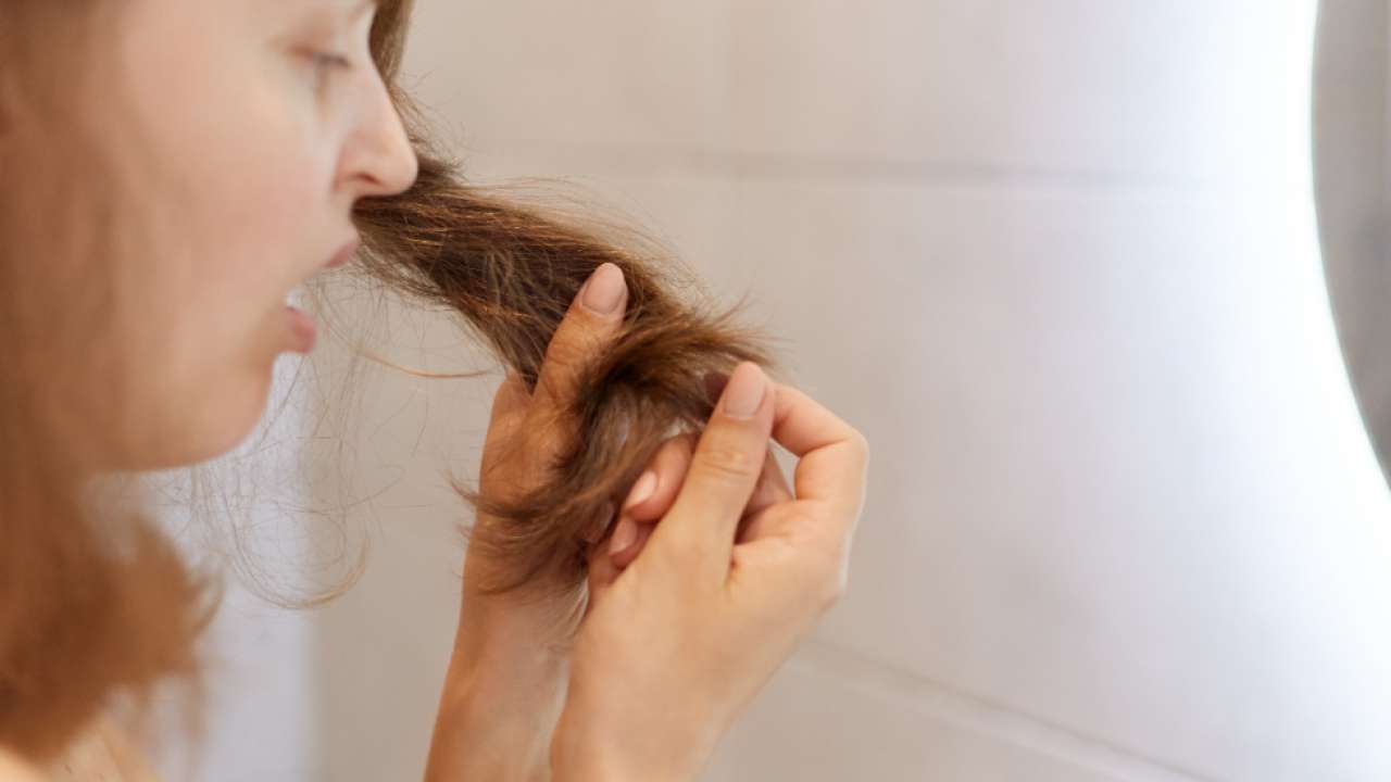 Here's how you can prevent premature greying of hair naturally