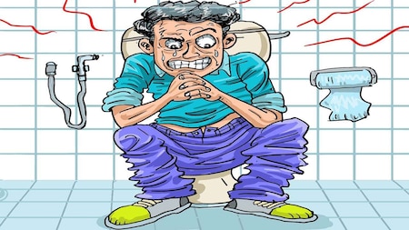 Treating constipation