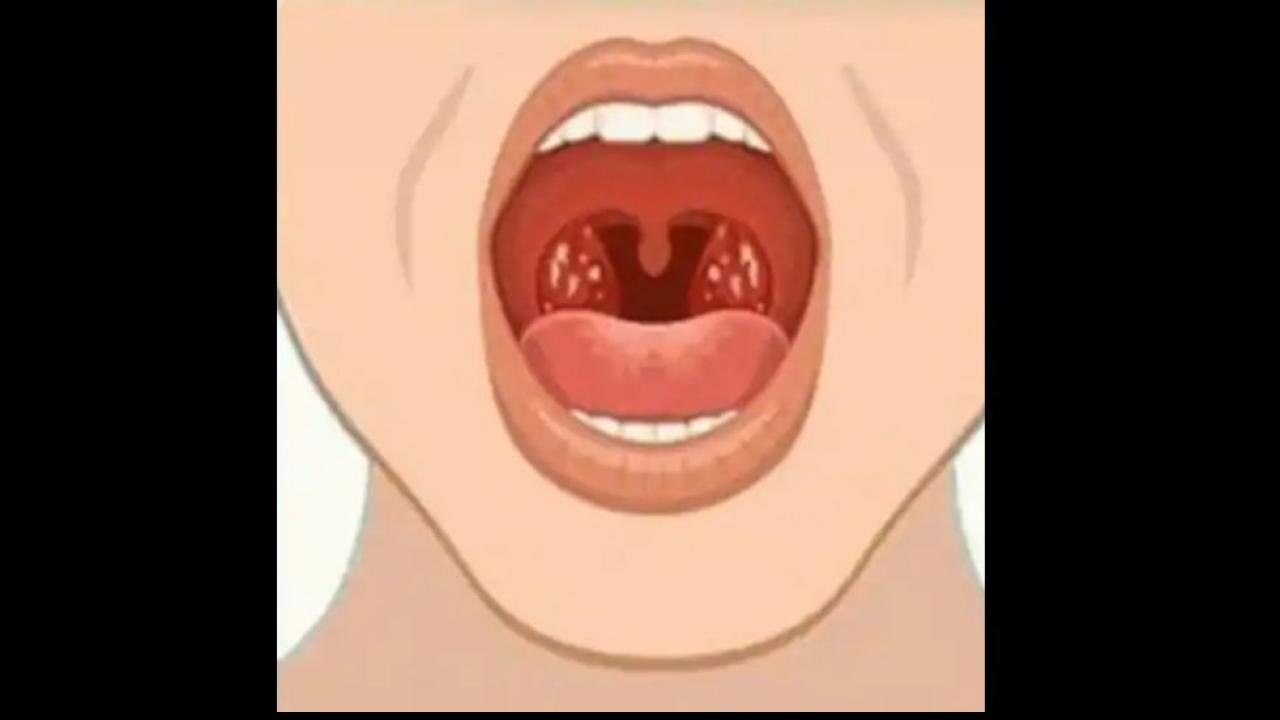 टॉन्सिल (Tonsils)