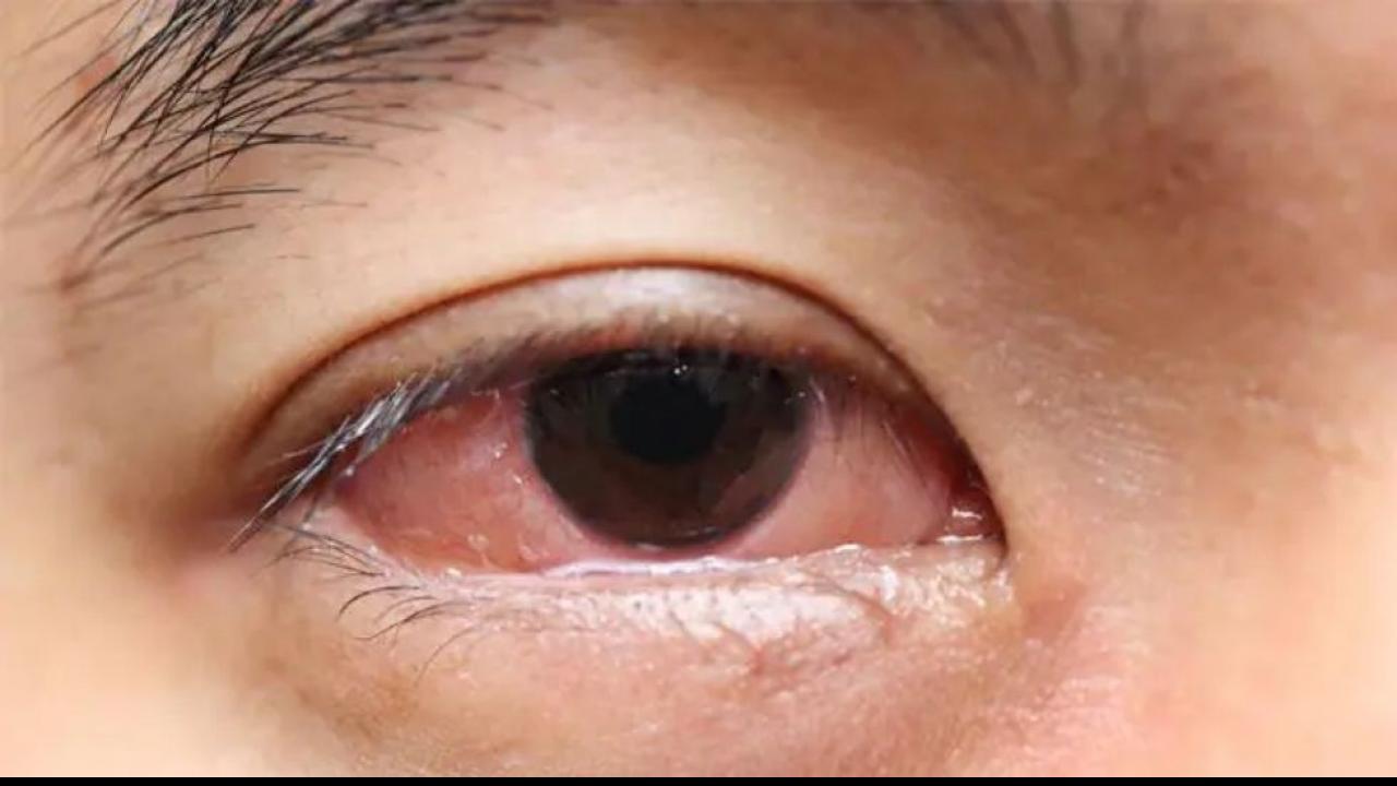 Eye Care: आंखें बताती हैं Health का पूरा हाल! जानिए क्या कहती हैं आंंखें | DNA HINDI