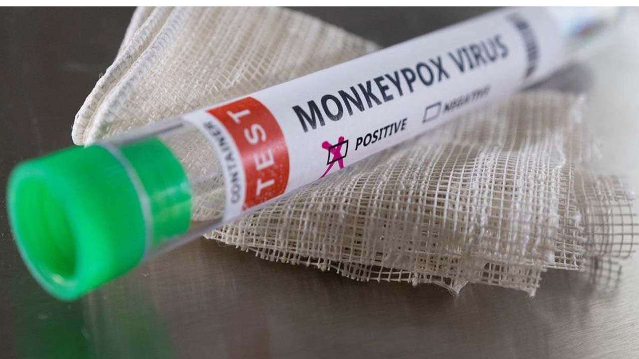 Chennai-based company made RT-PCR kit to detect monkeypox