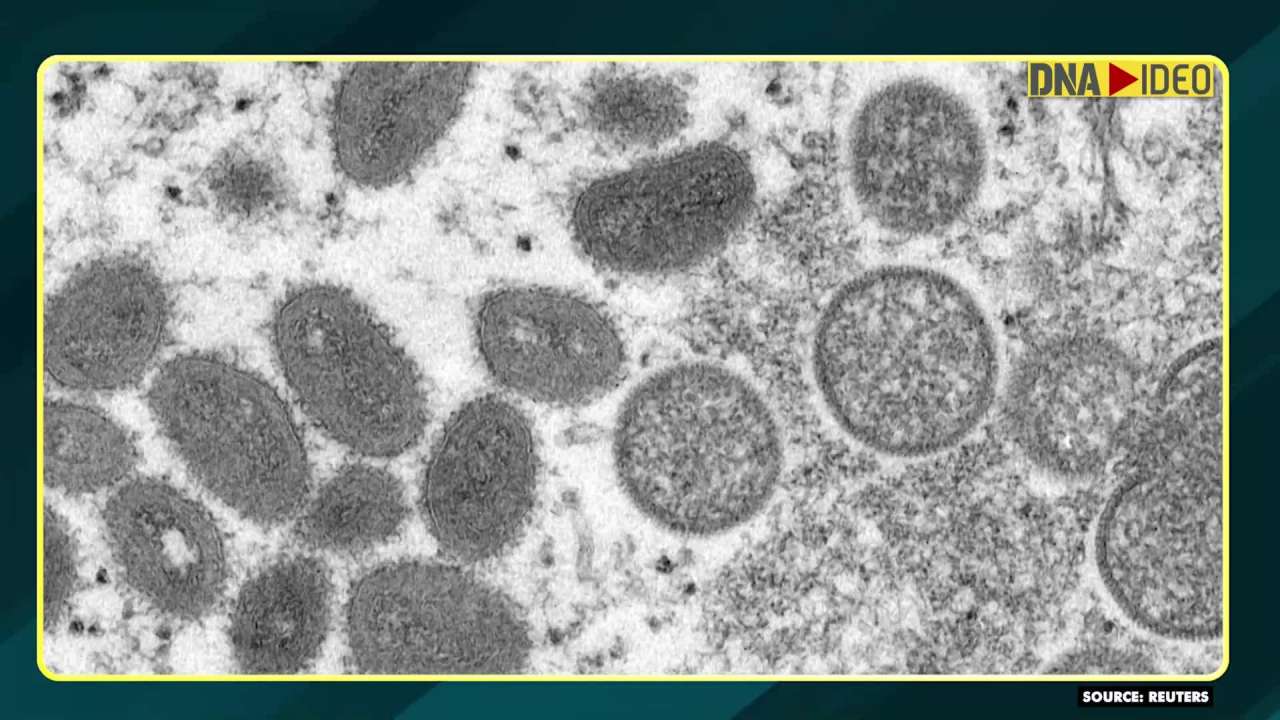 Unlikely monkeypox outbreak will lead to pandemic, says WHO
