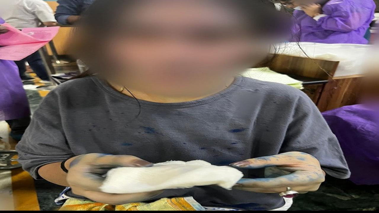'तू नहीं मानेगी...' कहते हुए रेप पीड़िता पर फेंकी स्याही, लड़की बोली- मंत्री के बेटे से जान का खतरा