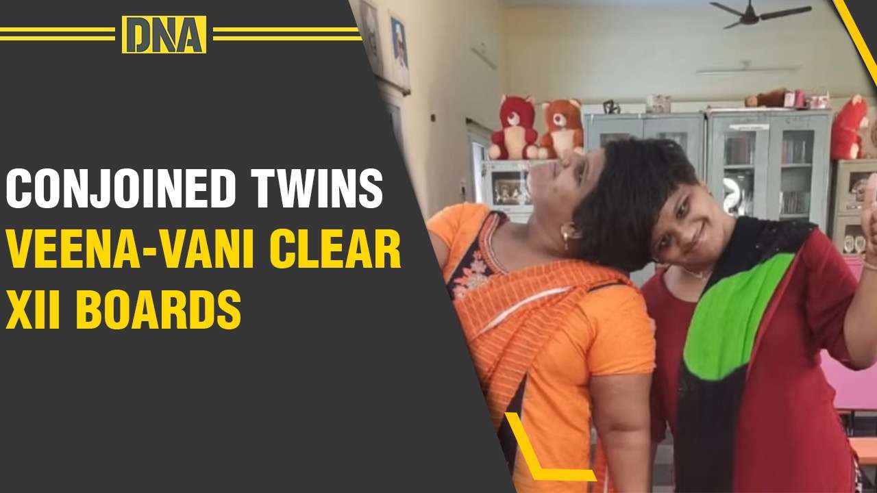 Conjoined twins Veena and Vani passed Class XII board exams in first class