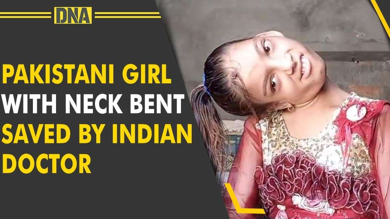 How a Pakistani girl with neck bent at 90 degrees saved by Indian doctor?