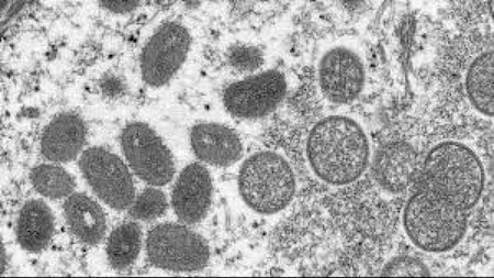 Is monkeypox a new disease?