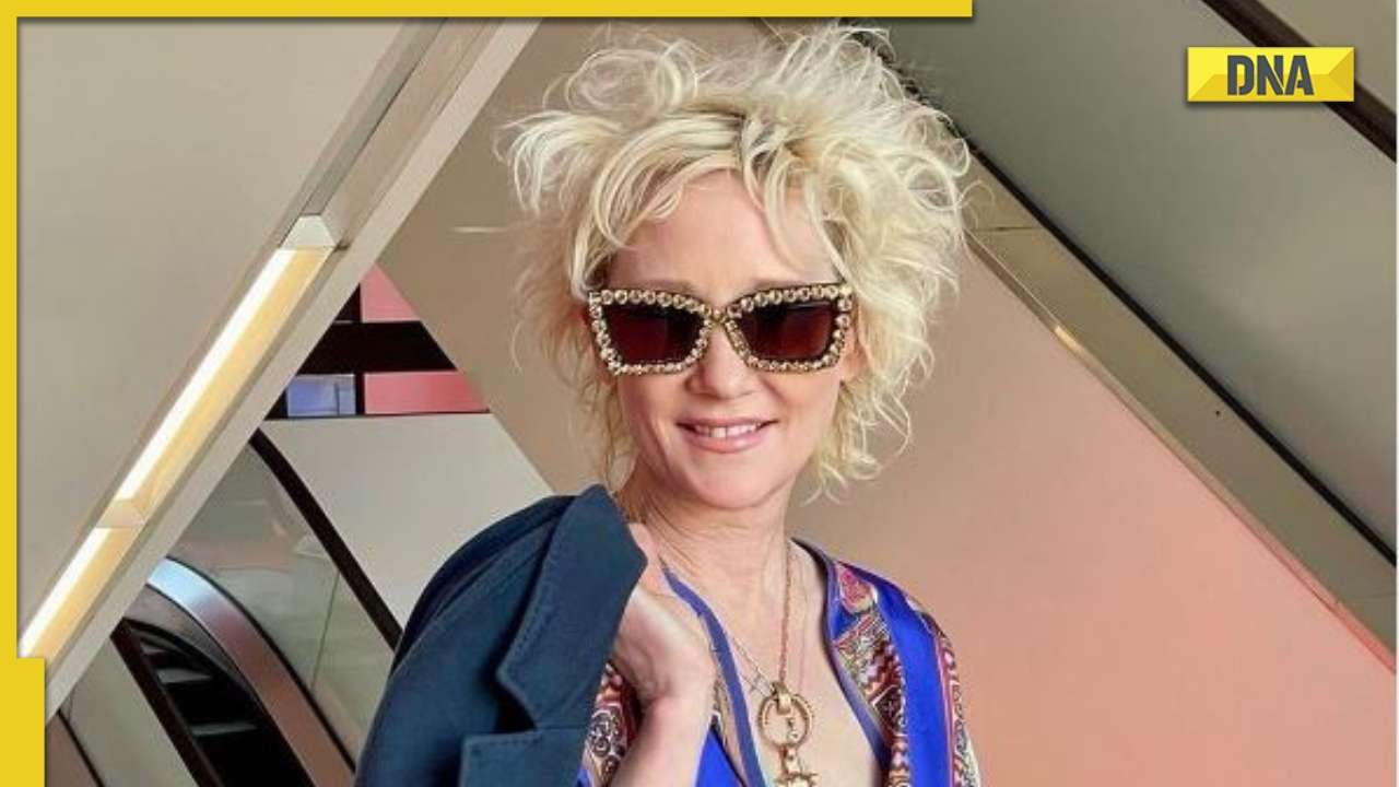 Anne Heche, Six Days Seven Nights actress, severely burned in car crash