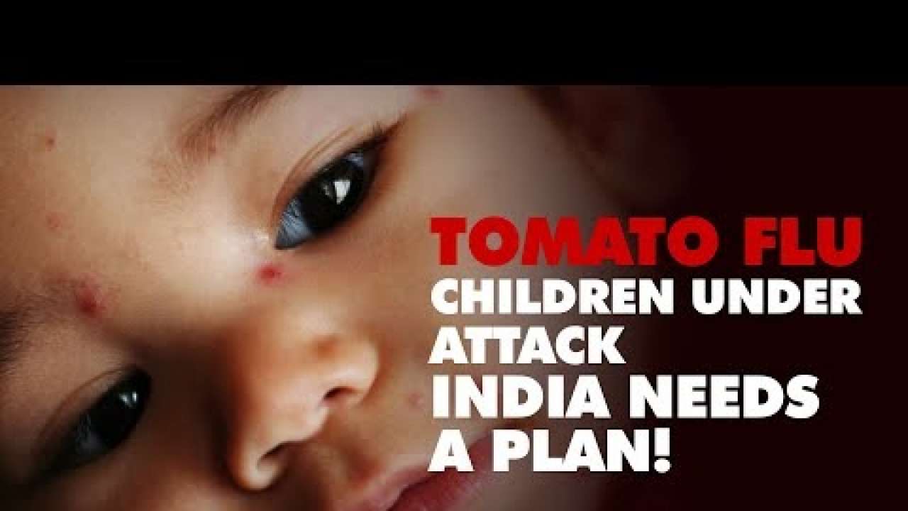 All you need to know about spreading 'TOMATO FLU' in India | SYMPTOMS | TREATMENT