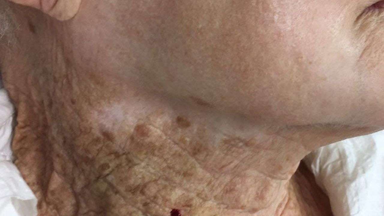 woman-uses-spf-on-her-face-and-not-on-neck-photo-of-her-damaged-neck