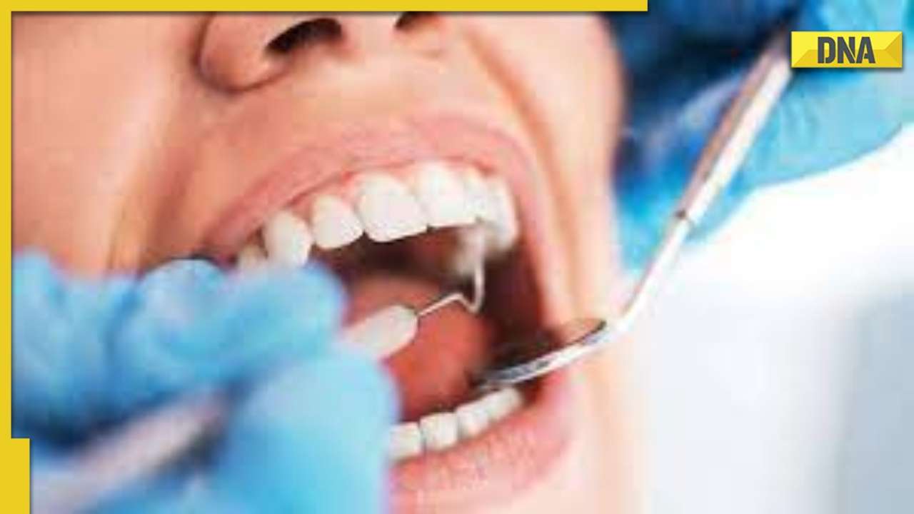 Dental Care 5 important tips to maintain oral hygiene