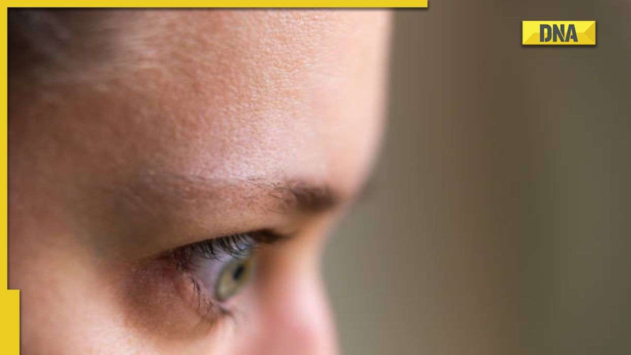 Graves disease all you need to know