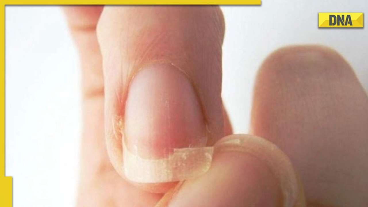 How Your Nails Can Show A Vitamin B12 Deficiency – wholier