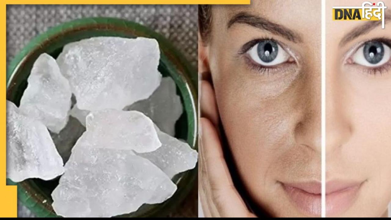 Skin Care Tips: फिटकरी से निखरेगा आपका चेहरा, यूज करने का तरीका जान लें 