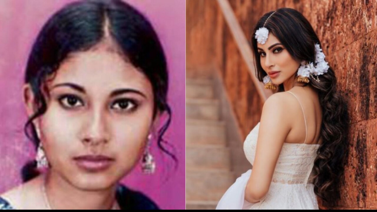 Mouni Roy Before And After Surgery