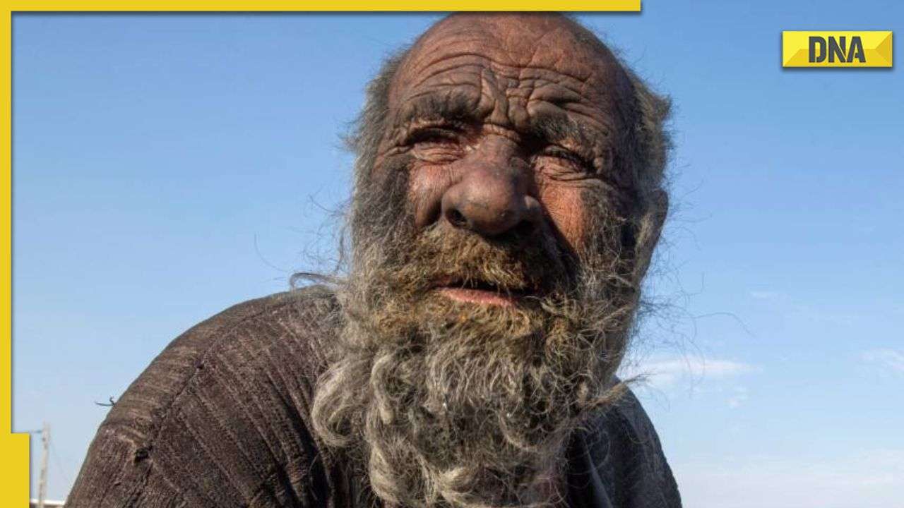 'World's dirtiest man' dies at 94, months after bathing for the first time in 60 years