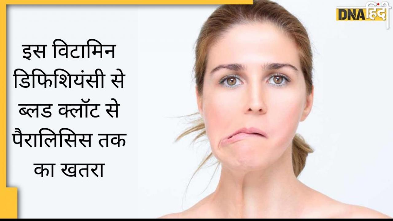 Blood Clotting Alert: विटामिन B-12 डिफिशिएंसी से ब्लड क्लॉटिंग और लकवा का भी खतरा, पहचान लें इसकी कमी के लक्षण