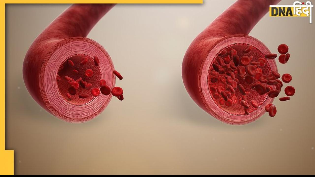Cholesterol: ब्लड में जमी वसा को गला देंगे ये तीन हरे साग, नसों की ब्लॉकेज खुल जाएगी