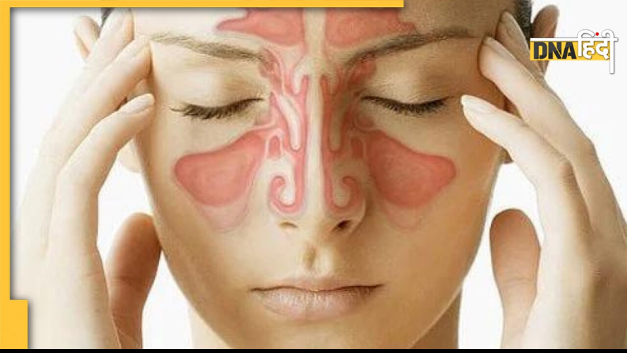 Sinus Home Remedies: नाक की हड्डी बढ़ना, सांस में तकलीफ, कहीं साइनस तो नहीं, क्या हैं घरेलू उपाय