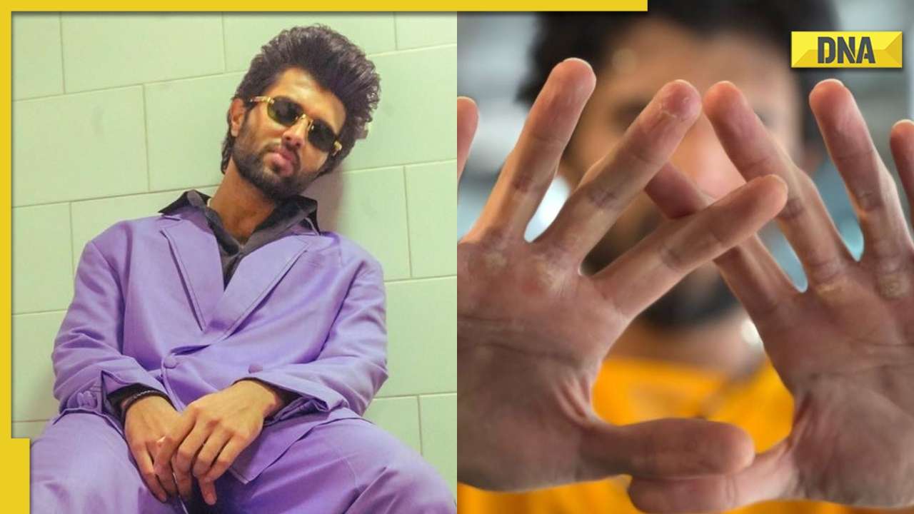 Vijay Deverakonda recovers from injury after 8 months of 'rehab', says  'beast is dying..'