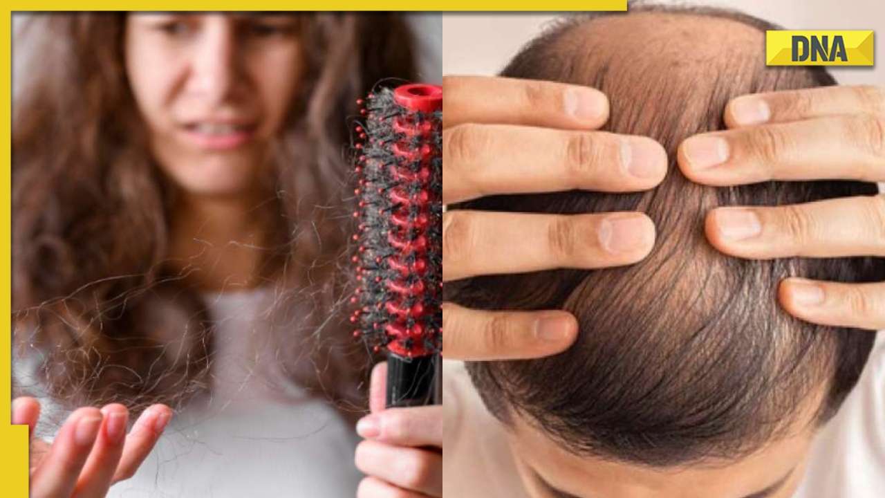 Shampoo your hair correctly to reduce excessive hairfall, here's how