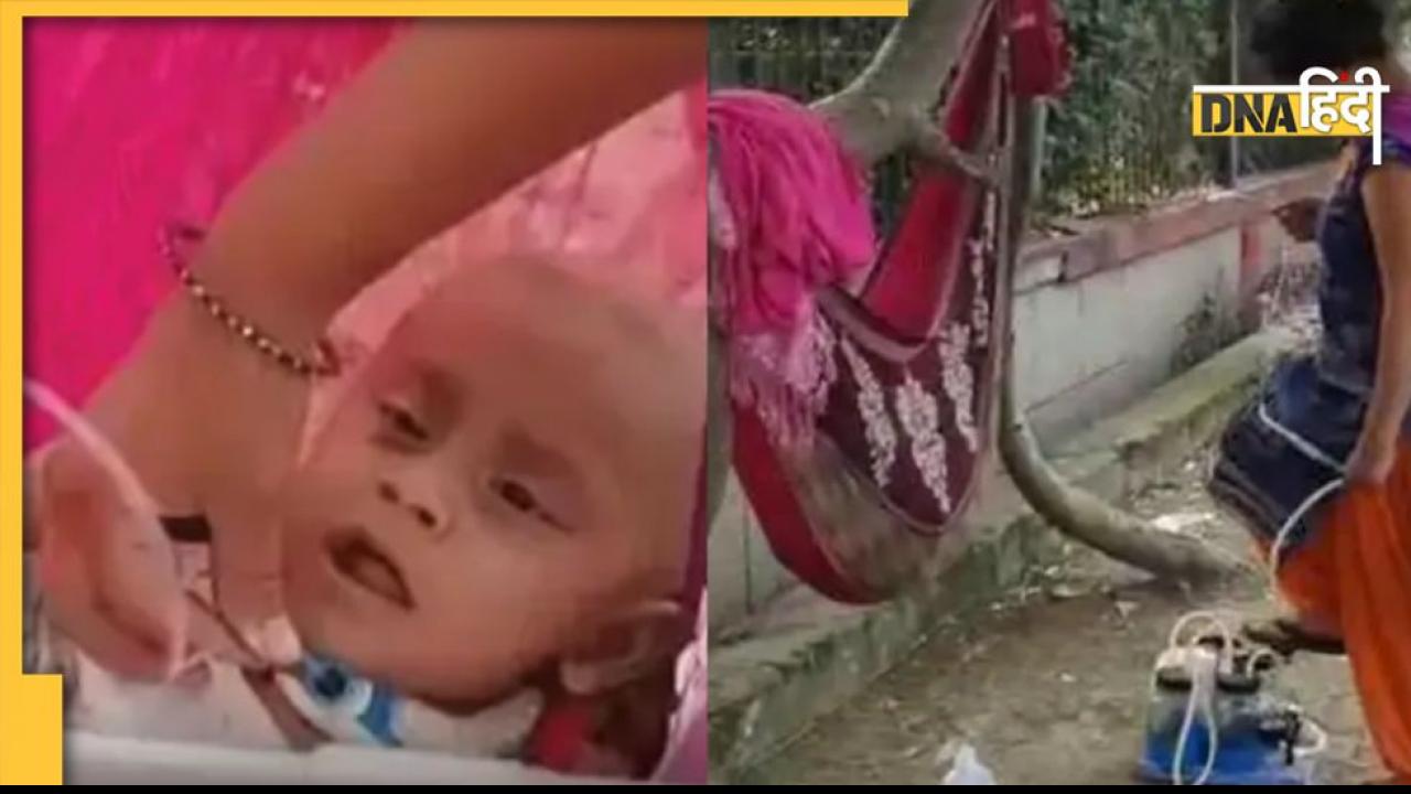 13 महीने के बच्चे को फुट पंप से ऑक्सीजन देती है मां, इलाज के लिए घर बेच सड़क पर रहने को मजबूर परिवार