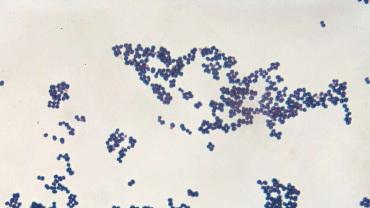 Lancet study THESE 5 bacteria responsible for at least 6.8 lakh deaths