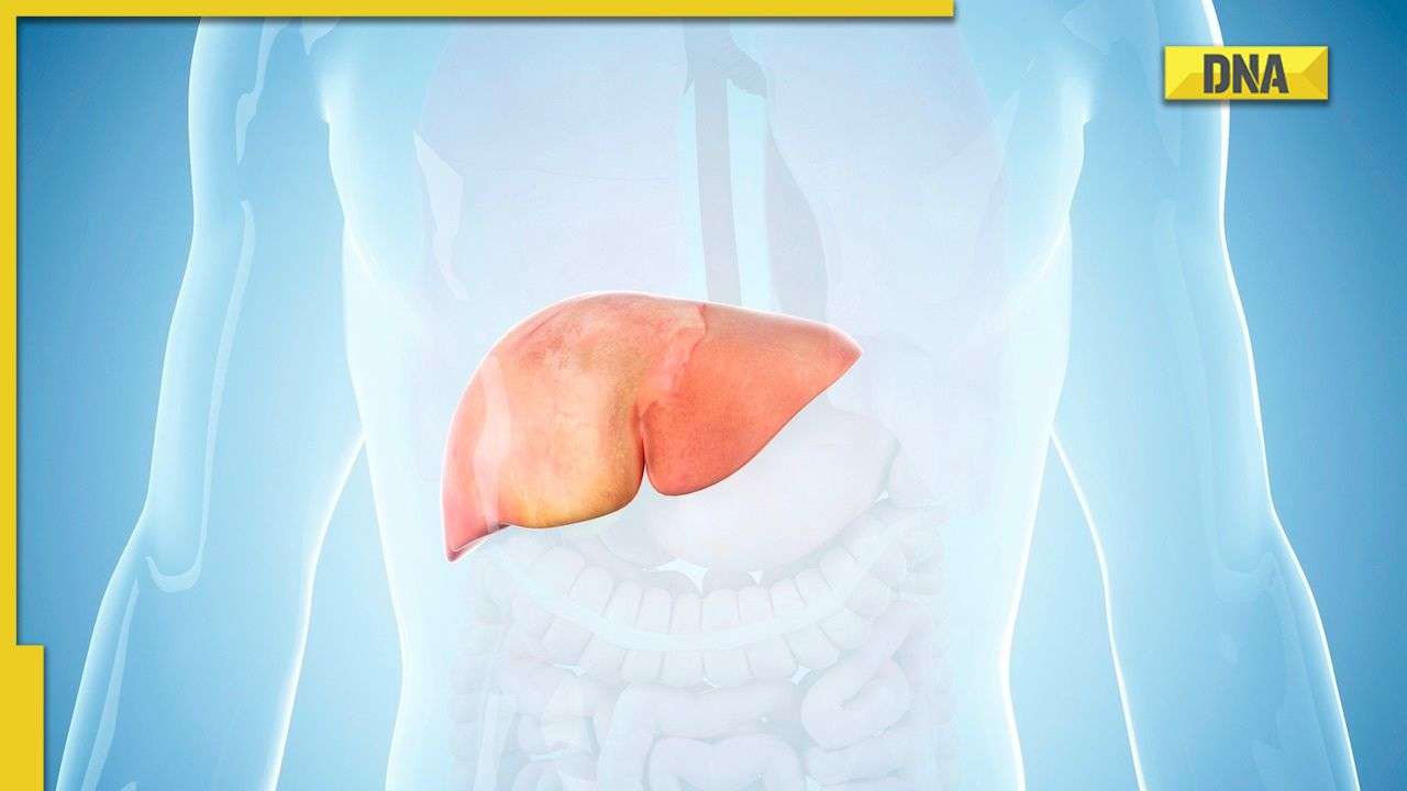 5 Incredible Home Remedies For Protection Against Fatty Liver 